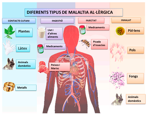 Malaltia al·lèrgica